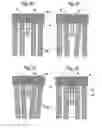 Fig. 15 - Interchangeable brush head with ultrasound action