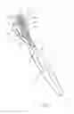 Fig. 02 - DOUBLE HEADED TOOTHBRUSH WITH FLOSS