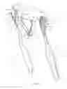 Fig. 03 - DOUBLE HEADED TOOTHBRUSH WITH FLOSS