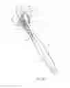 Fig. 08 - DOUBLE HEADED TOOTHBRUSH WITH FLOSS
