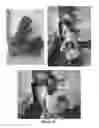 Fig. 11 - Head support and method of using the same