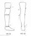 Fig. 03 - COMPRESSION SOCK, DEVICE FOR DONNING/REMOVING THE SOCK, AND METHOD FOR DONNING/REMOVING THE SOCK