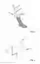 Fig. 02 - Putting-on aid for a support stocking