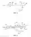 Fig. 03 - Minimally invasive surgical system