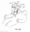 Fig. 31 - Minimally invasive surgical system