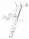 Fig. 02 - Endotracheal tube insertion device