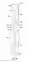 Fig. 42 - Endotracheal tube insertion device
