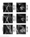 Fig. 08 - Coherence-gated wavefront-sensorless adaptive-optics multi-photon microscopy, and associated systems and methods