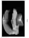 Fig. 12 - Method and system for pupil retro illumination using sample arm of OCT interferometer