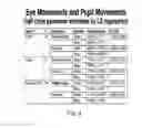 Fig. 03 - Method and apparatus for mTBI diagnosis implementing eye movement and pupil movement analysis in objective vergence testing