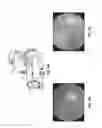 Fig. 17 - Removal of non-retinal opthalmic reflections in retinal imaging