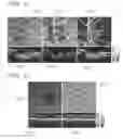 Fig. 10 - In vivo optical flow imaging