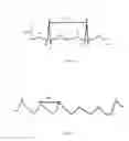 Fig. 07 - WEARABLE DEVICE FOR ASSESSING THE LIKELIHOOD OF THE ONSET OF CARDIAC ARREST AND A METHOD THEREO