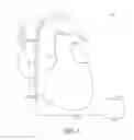 Fig. 03 - Atrial fibrillation detection