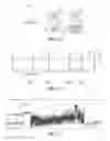 Fig. 10 - Atrial fibrillation detection