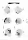Fig. 11 - Assessing intra-cardiac activation patterns