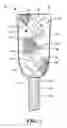 Fig. 03 - Pericardial balloon mapping