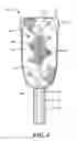 Fig. 05 - Pericardial balloon mapping