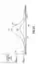 Fig. 25 - Apparatuses, systems and methods for detection of an ingested battery or magnet