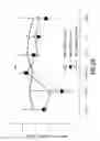 Fig. 26 - Apparatuses, systems and methods for detection of an ingested battery or magnet