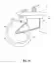 Fig. 02 - Patient mobility assessment device