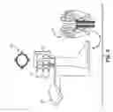 Fig. 06 - Prosthetic limb sensory system for improved balance control