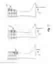 Fig. 08 - Prosthetic limb sensory system for improved balance control