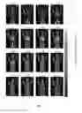 Fig. 12 - SYSTEMS AND METHODS FOR DETERMINING IMAGE QUALITY AND MODELS BASED ON CONTRAST INJECTION PROTOCOLS