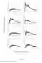 Fig. 16 - SYSTEMS AND METHODS FOR DETERMINING IMAGE QUALITY AND MODELS BASED ON CONTRAST INJECTION PROTOCOLS