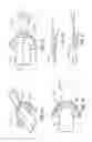 Fig. 02 - Method of making a customized intraoral positioning device for user radiation therapy treatment
