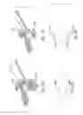Fig. 11 - Method of making a customized intraoral positioning device for user radiation therapy treatment