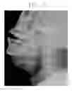 Fig. 04 - Three-dimensional image generating method and system using multi-energy X-ray image and optical image
