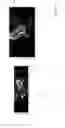 Fig. 08 - Systems and methods for emulating DEXA scores based on CT images