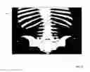 Fig. 10 - Systems and methods for emulating DEXA scores based on CT images