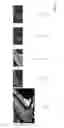 Fig. 13 - Systems and methods for emulating DEXA scores based on CT images