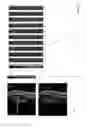 Fig. 14 - Systems and methods for emulating DEXA scores based on CT images