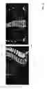 Fig. 16 - Systems and methods for emulating DEXA scores based on CT images