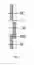 Fig. 05 - Quantification phantom for use with multiple imaging modalities
