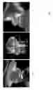 Fig. 05 - Multi-view, multi-source registration of moving anatomies and devices