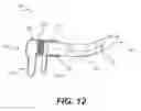 Fig. 09 - Articulating needles and related methods of use