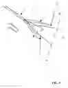 Fig. 06 - Method and device for tissue acquisition or closure