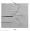 Fig. 07 - Method and device for tissue acquisition or closure