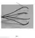 Fig. 08 - Method and device for tissue acquisition or closure