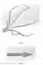 Fig. 09 - Method and device for tissue acquisition or closure