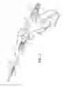 Fig. 02 - Surgical instrument with articulation region