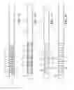 Fig. 08 - Surgical instrument with articulation region