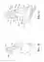 Fig. 12 - Surgical instrument with articulation region