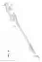 Fig. 18 - Surgical instrument with articulation region