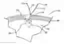 Fig. 01 - Non-sliding soft anchor