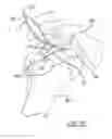 Fig. 09 - Non-sliding soft anchor